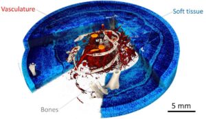 Spektral- og fasekontrast-CT kombinerer styrker for at forbedre røntgenbilleder – Physics World