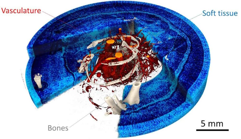 CT ספקטרלי וניגודיות פאזה משלבים עוצמות לשיפור הדמיית רנטגן - עולם הפיזיקה