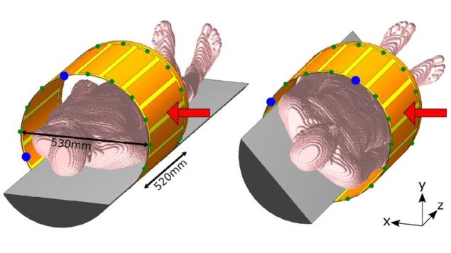 3D model of the radiation-transparent body coil