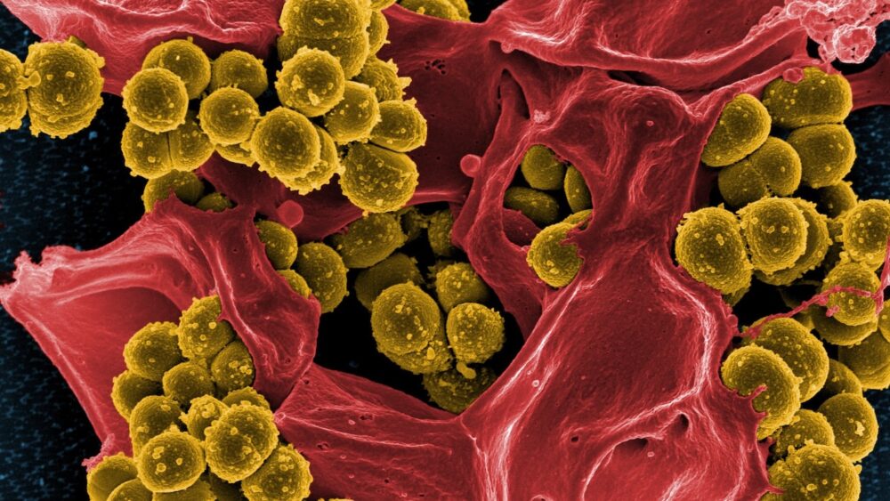 AI Unearths Nearly a Million Potential Antibiotics to Take Out Superbugs