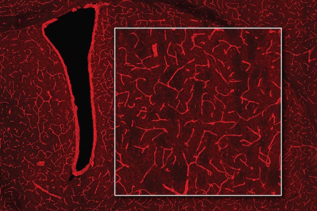 An image of blood vessels in the brain resembling a complex embroidery of bright-red threads on a black background